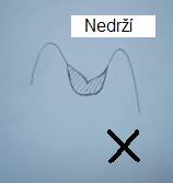 Amalgám nedrží