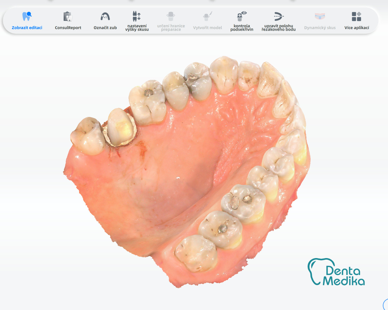 Dentamedika Brno - skener 1