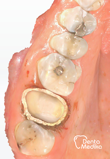 Dentamedika Brno - skener 3