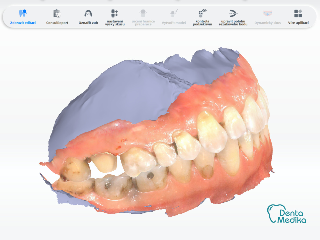 Dentamedika Brno - skener 4