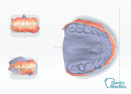 Dentamedika Brno - skener 5