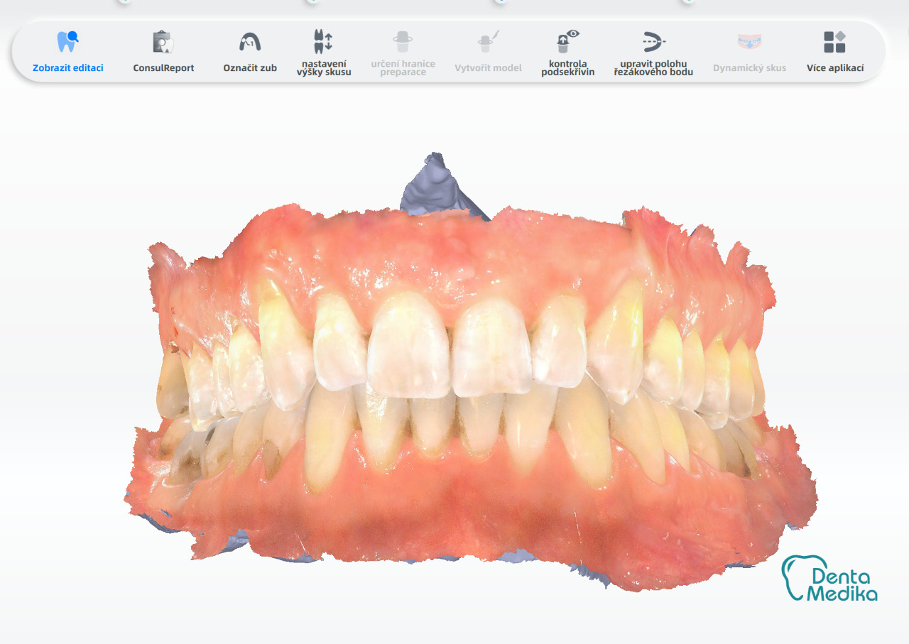 Dentamedika Brno - skener 3