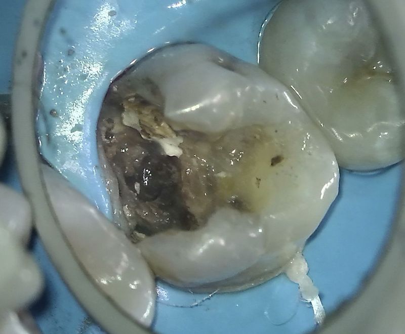 Zubní chirurgie Brno - VFP - Dentamedika.cz _1