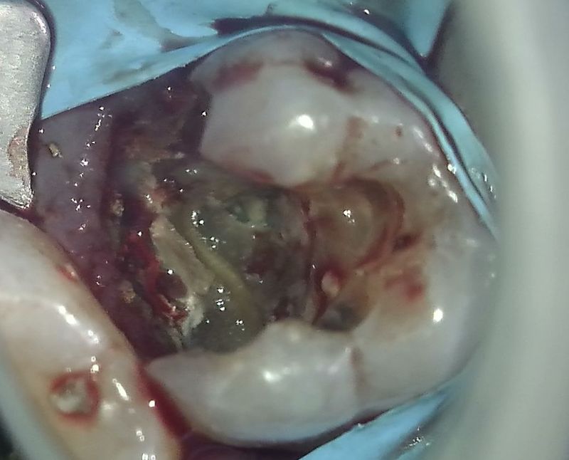 Zubní chirurgie Brno - VFP - Dentamedika.cz _2