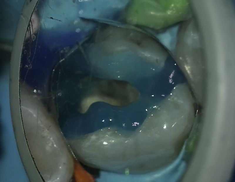 Zubní chirurgie Brno - VFP - Dentamedika.cz _4