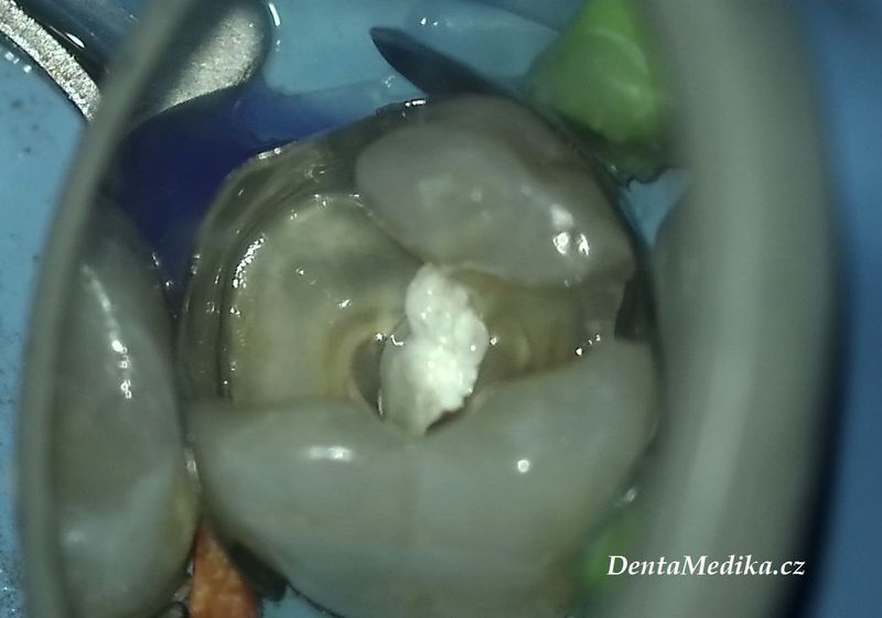 Zubní chirurgie Brno - VFP - Dentamedika.cz _5