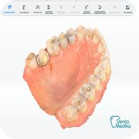 Zubní skener Dentamedika Brno