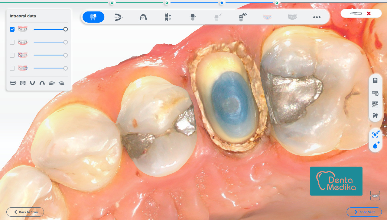 Dentamedika Brno - skener 8