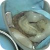 Stomatologická chirurgie Brno - VFP
