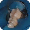 Implantáty zubů Brno - Dentamedika.cz - 13